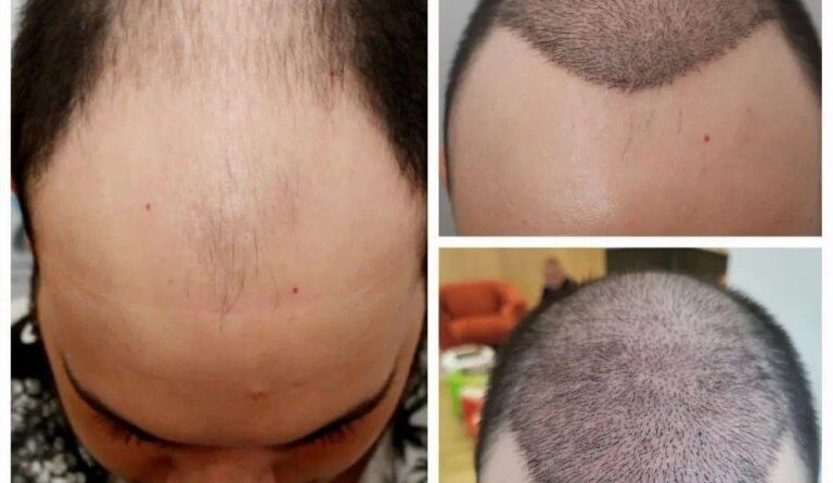 implant-par-dr-felix_81