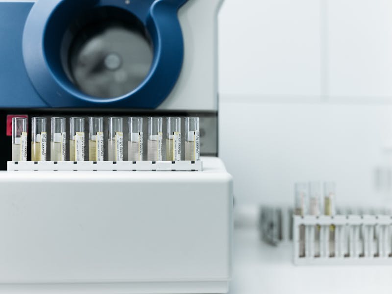 analize glanda tiroida