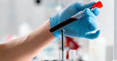 listă extinsă de analize de sânge